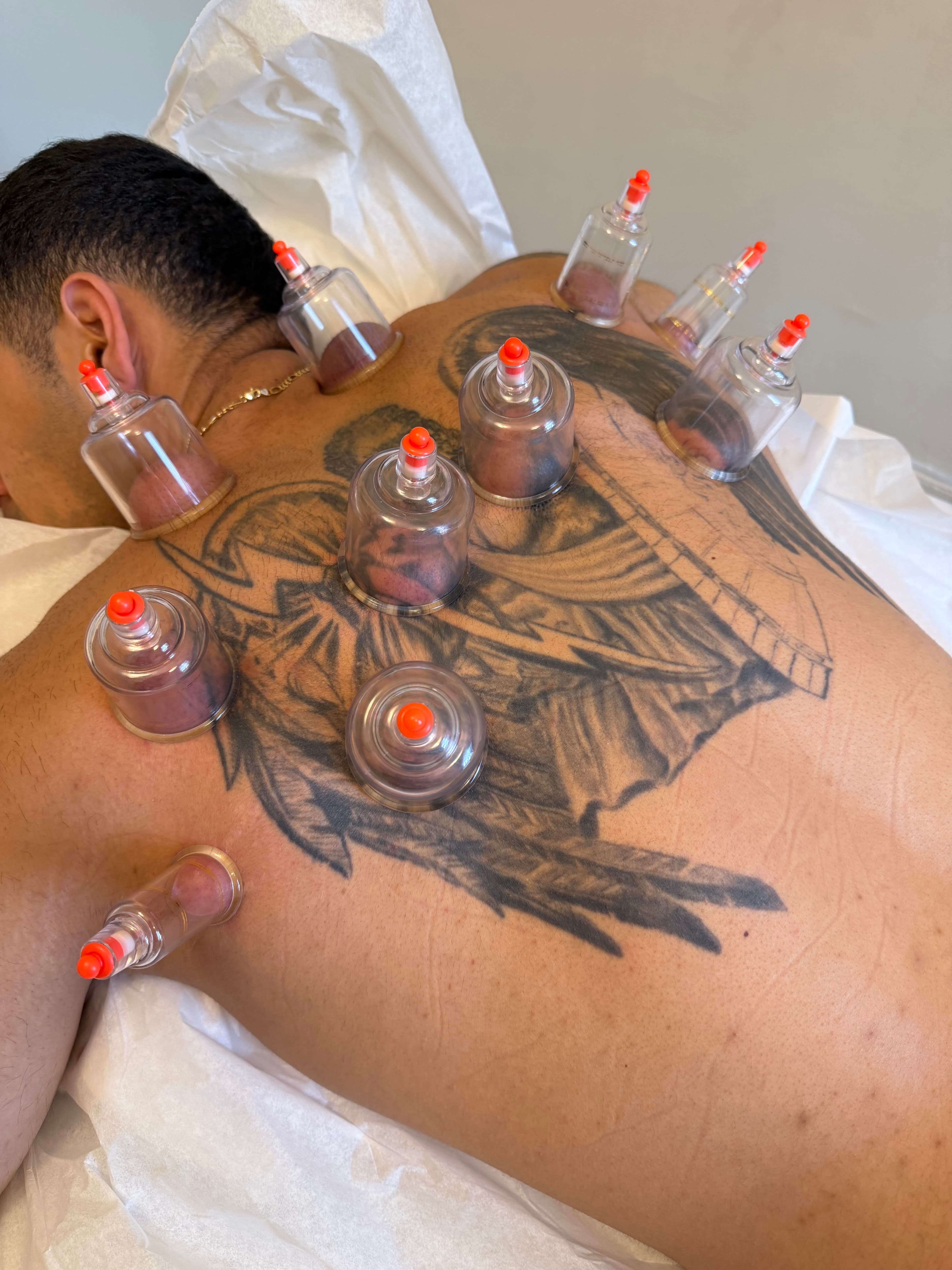 Traditional cupping therapy to improve circulation and relieve tension